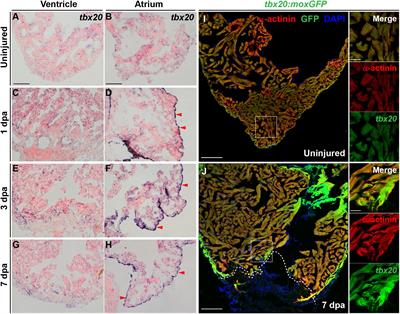 Tbx20 Induction Promotes Zebrafish Heart Regeneration by Inducing Cardiomyocyte Dedifferentiation and Endocardial Expansion